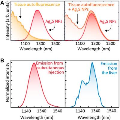 Luminescence Thermometry for Brain Activity Monitoring: A Perspective